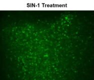 Cell Meter™ Fluorimetric Intracellular Peroxynitrite Assay Kit *Green Fluorescence*