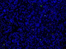 Cell Meter™ Apoptotic and Necrotic Multiplexing Detection Kit  *Triple Fluorescence Colors*