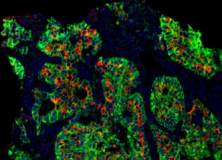 iFluor® 488 PSA™ Imaging Kit with Goat Anti-Rabbit IgG