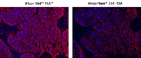 iFluor® 594™ PSA™ Imaging Kit with Goat Anti-Mouse IgG